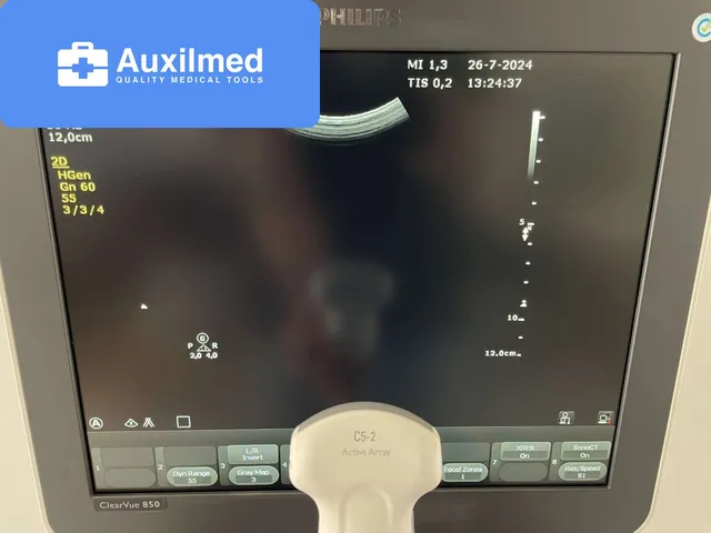 Philips ClearVue 850 Ultrasound