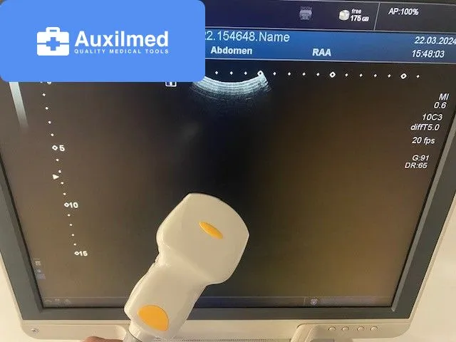 Toshiba Xario 200 Ultrasound (2014)