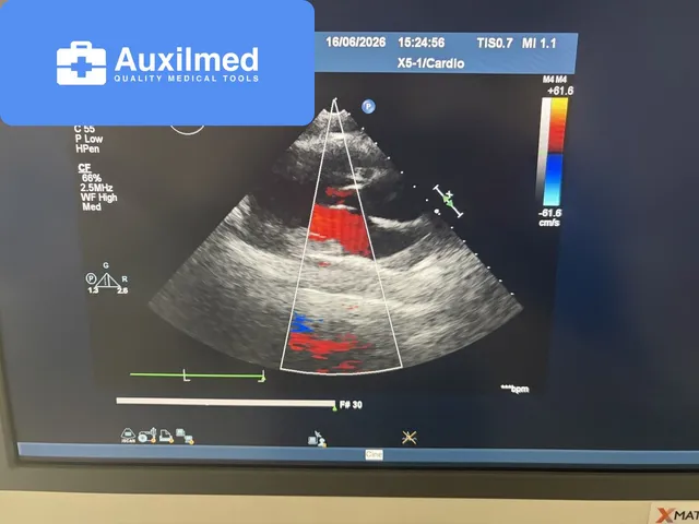 Philips iE33 XMatrix Ultrasound System