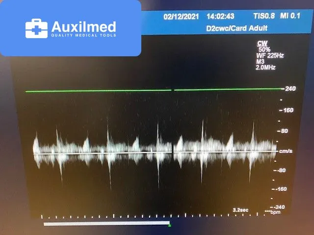 Philips D2cwc Transducer
