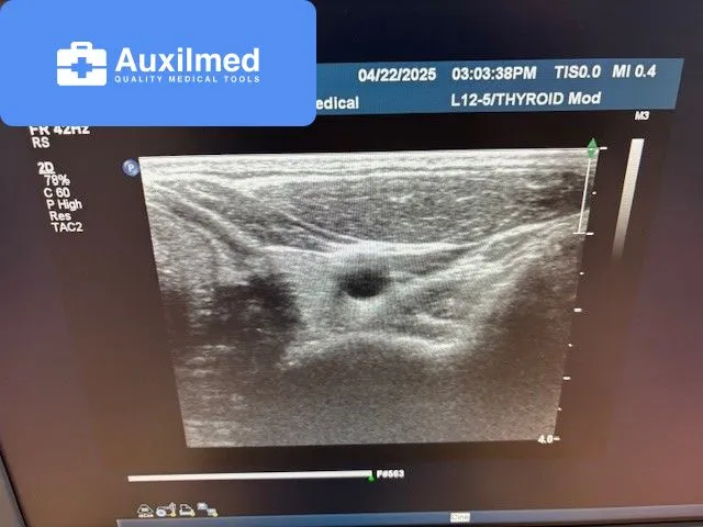 Philips L12-5 Transducer