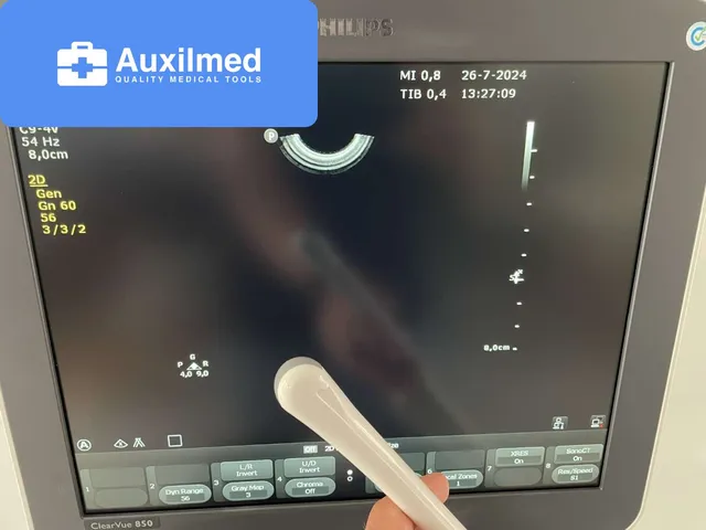 Philips ClearVue 850 Ultrasound