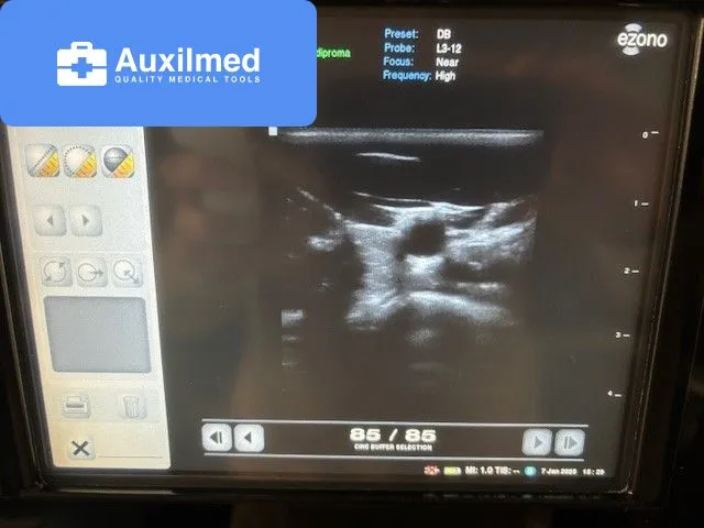 eZono 3000 Ultrasound (9100100623)