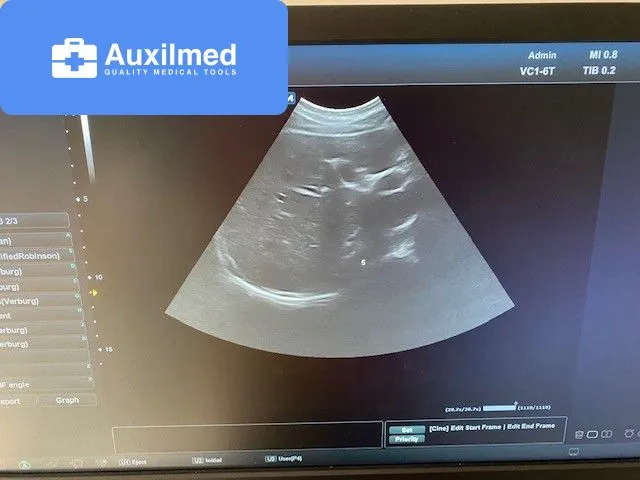 Alpinion E-CUBE 8 Ultrasound