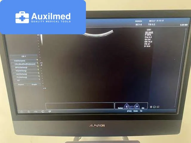 Alpinion E-CUBE 11 Ultrasound