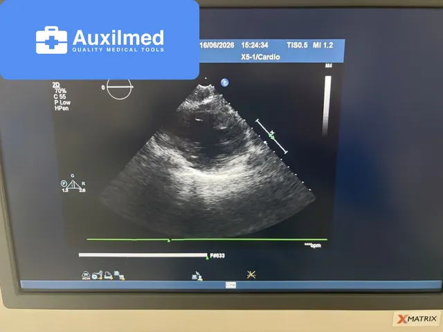 Philips iE33 XMatrix Ultrasound System
