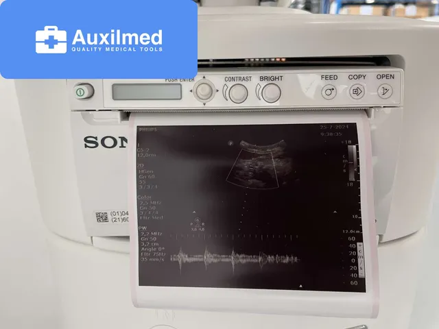 Philips ClearVue 850 Ultrasound