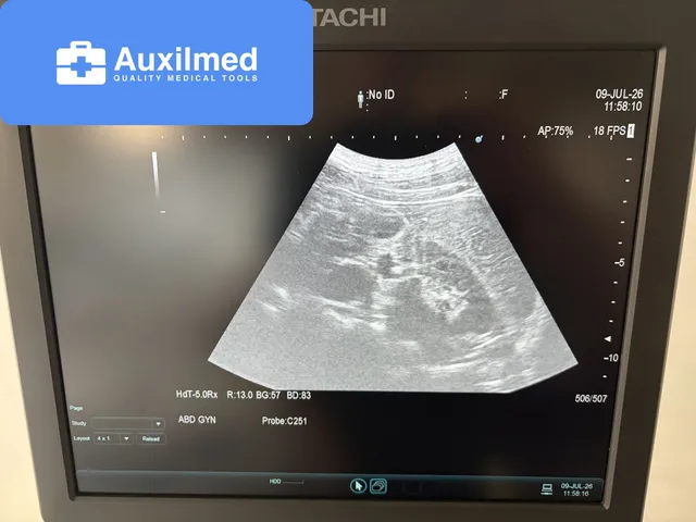 Hitachi Arietta V60 Ultrasound (20620279)