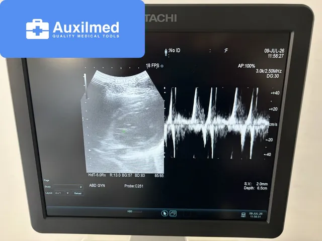 Hitachi Arietta V60 Ultrasound (20620279)