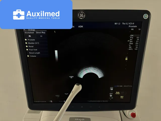 GE LOGIQ E9 Ultrasound