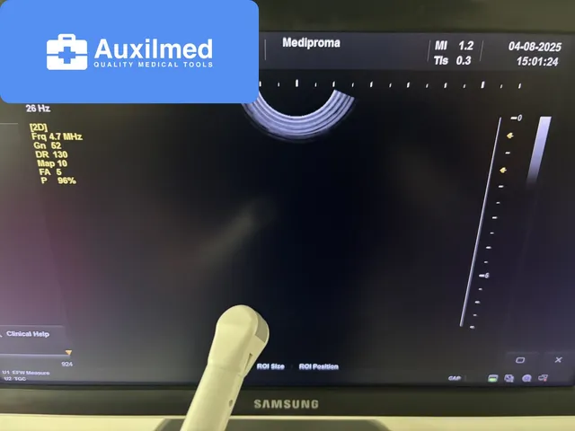 Samsung H60 Ultrasound