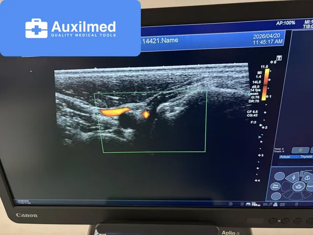 Canon Aplio a Ultrasound