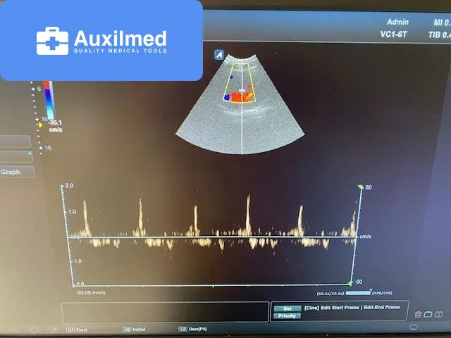Alpinion E-CUBE 8 Ultrasound