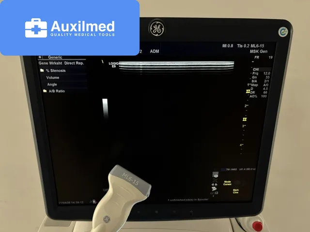 GE LOGIQ E9 Ultrasound