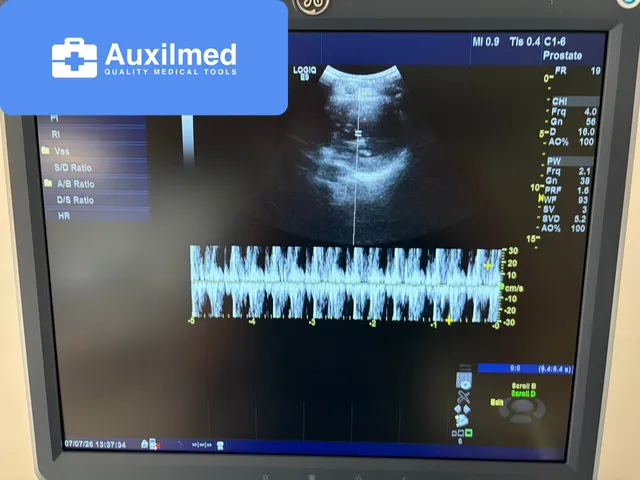 GE LOGIQ E9 Ultrasound (119487US7)
