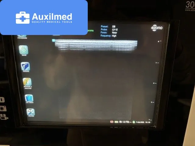 eZono 3000 Ultrasound (9100100623)