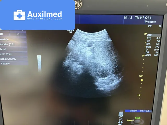 GE LOGIQ E9 Ultrasound (119487US7)