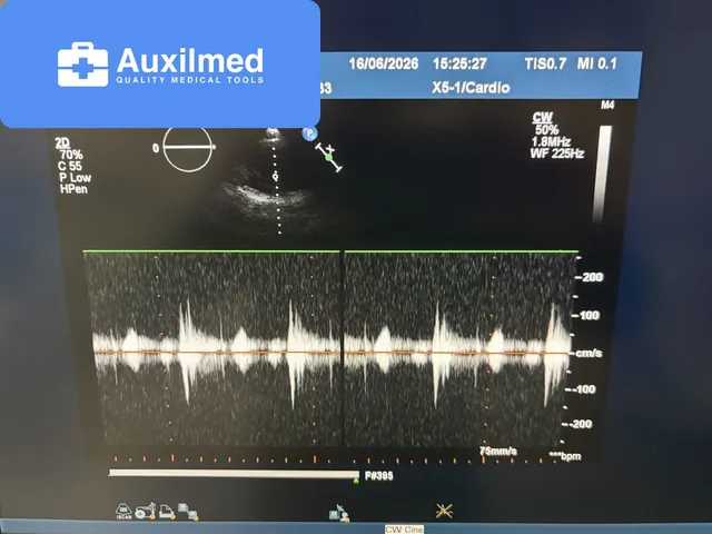 Philips iE33 XMatrix Ultrasound System