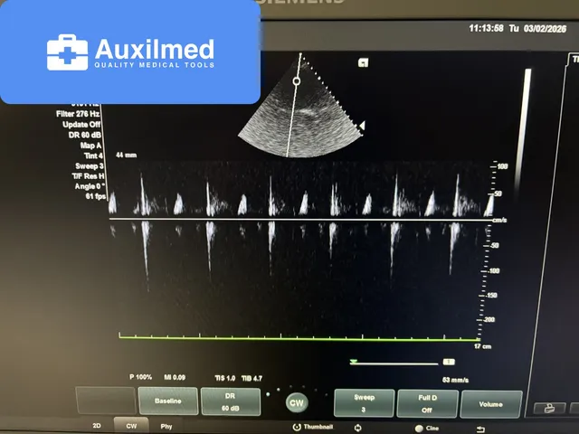 Siemens Acuson NX2 Ultrasound (21 520865)
